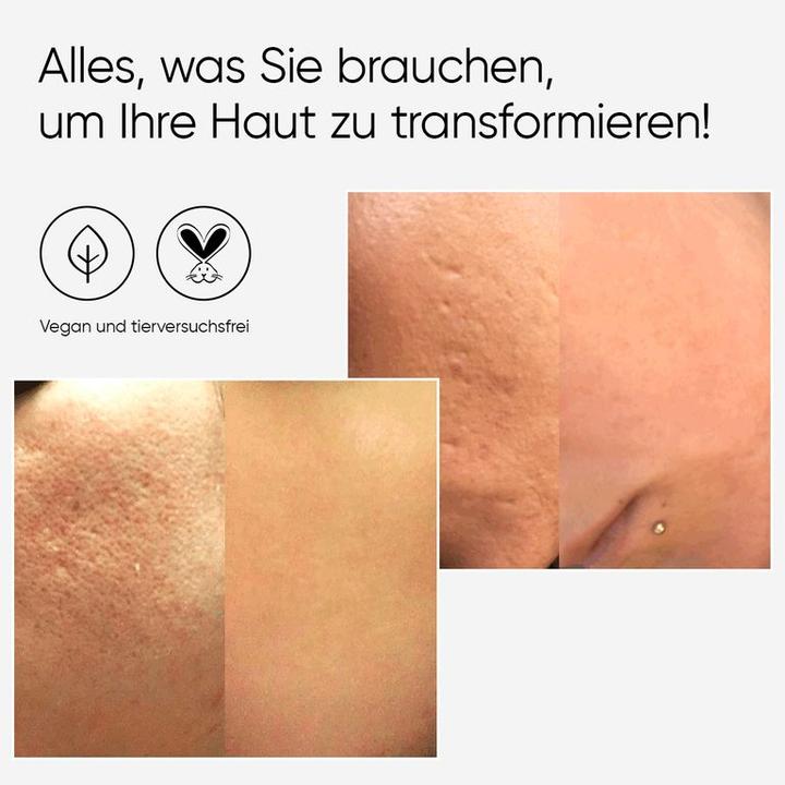 Produktbild Âme pure Cit Face Roller Basic