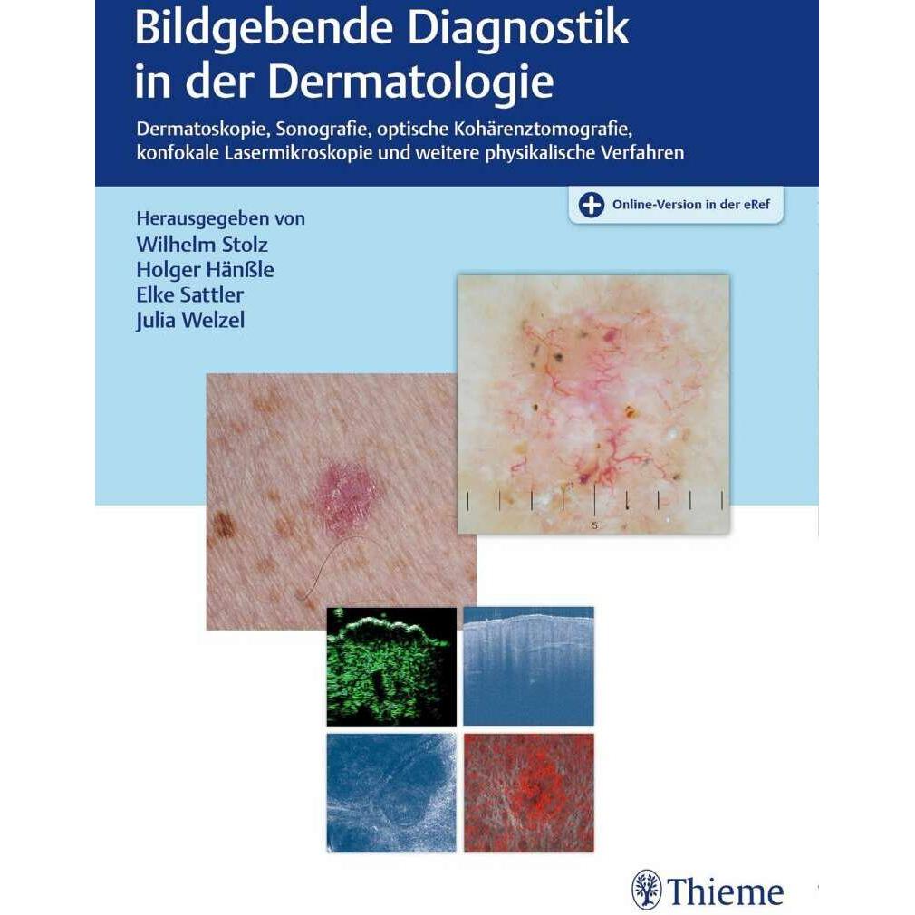 Bildgebende Diagnostik in der Dermatologie, Fachbücher von Holger Hänssle, Julia Welzel, Wilhelm Stolz, Elke Sattler