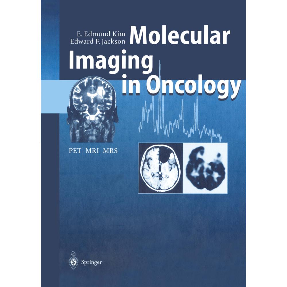 Molecular Imaging in Oncology, Fachbücher von E. Edmund Kim, Edward F. Jackson