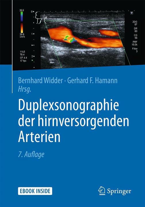 Produktbild Duplexsonographie der hirnversorgenden Arterien (Deutsch, Bernhard Widder, Gerhard F. Hamann, 2018)