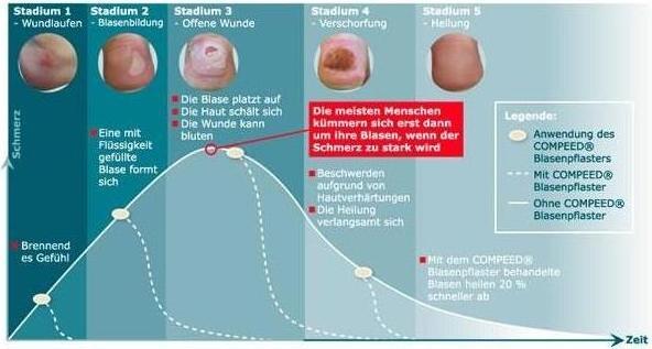 Image du produit Compeed Pansement blister Petit (6 x)
