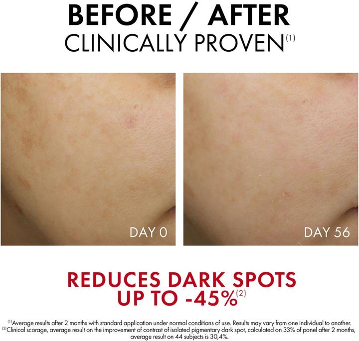 Actual product image Vichy Liftactiv B3 Retinol Night Cream (50 ml, Night cream, SPF 50)