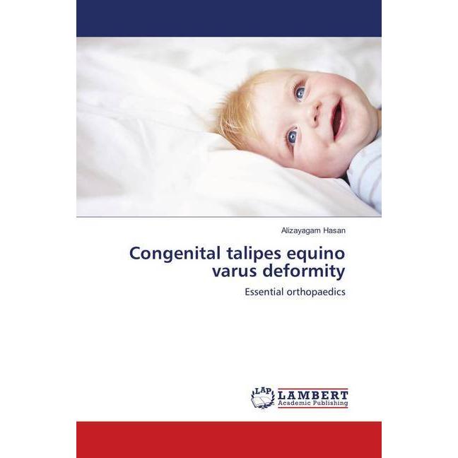 Congenital talipes equino varus deformity, Fachbücher von Alizayagam Hasan