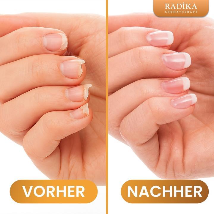 Productafbeelding Radika Nagelolie, nagelverzorging, handcrème, 100% puur, biologisch, natuurlijk, 10 ml (10 ml)