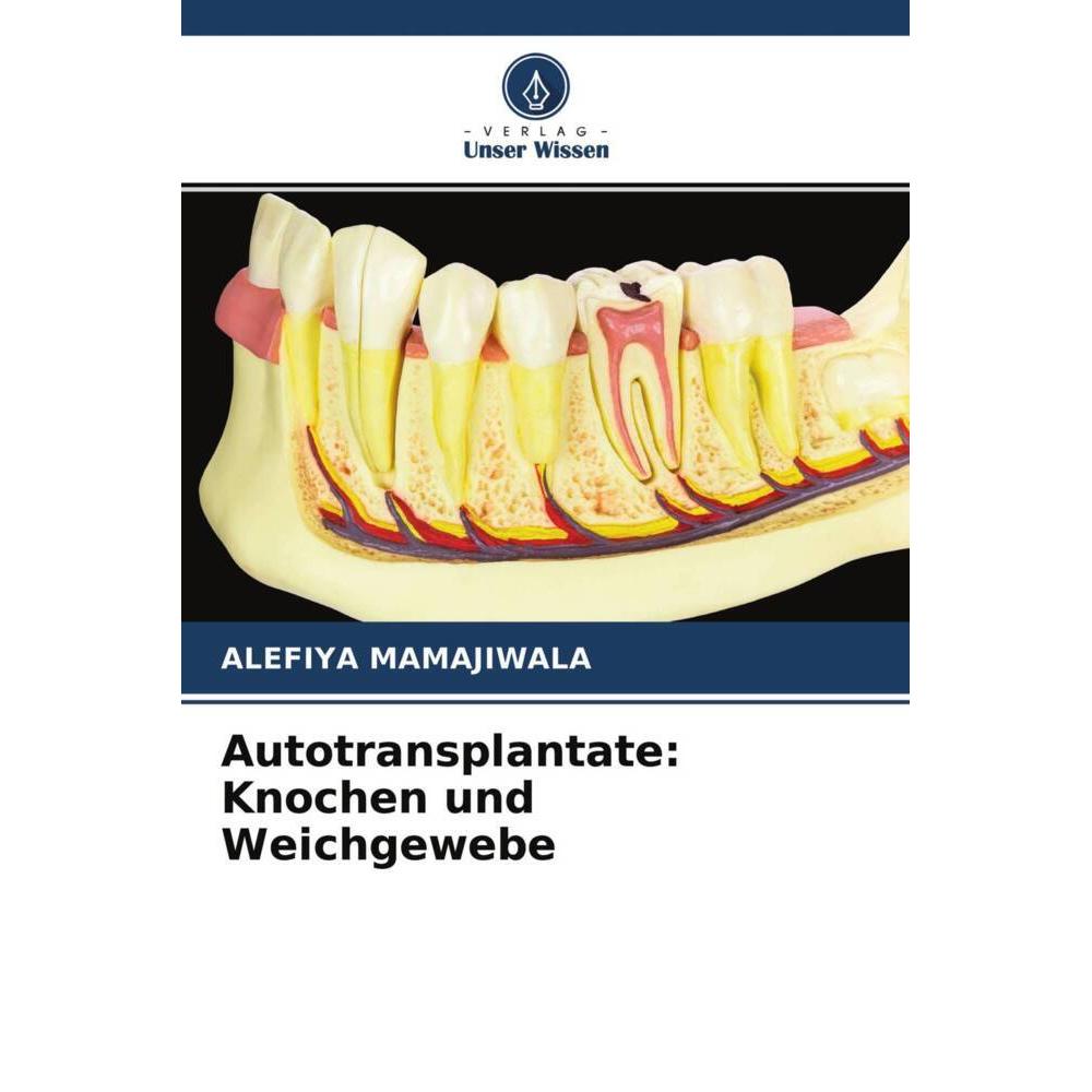 Autotransplantate: Knochen und Weichgewebe, Fachbücher von Alefiya Mamajiwala