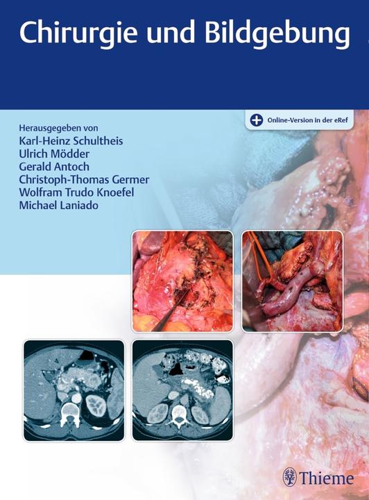 Produktbild Chirurgie und Bildgebung (Deutsch, Christoph-Thomas Germer, Gerald Antoch, Karl-Heinz Schultheis, Ulrich Mödder, Wolfram Trudo Knoefel, 2018)