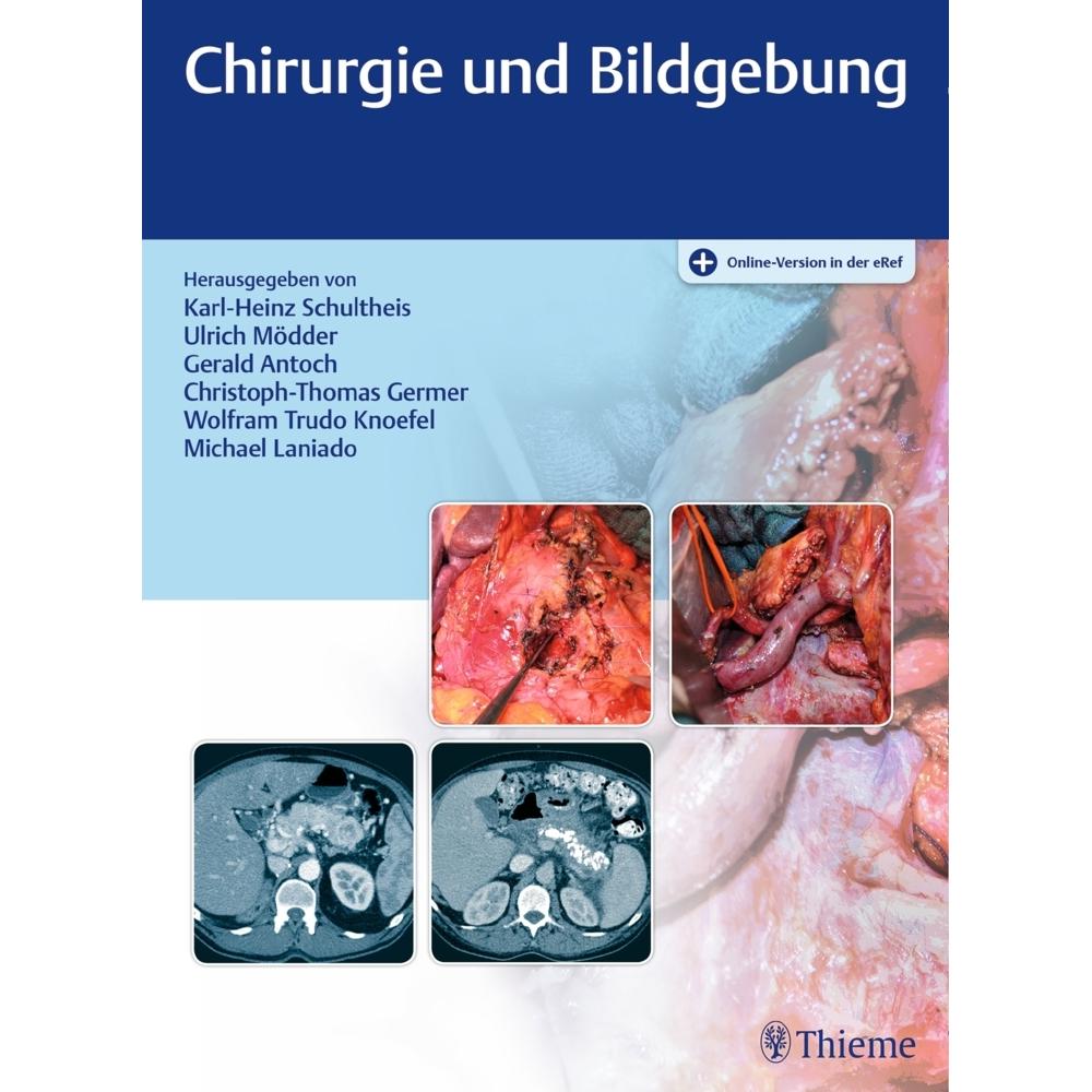 Chirurgie und Bildgebung, Fachbücher von Christoph-Thomas Germer, Ulrich Mödder, Wolfram Trudo Knoefel, Gerald Antoch, K...