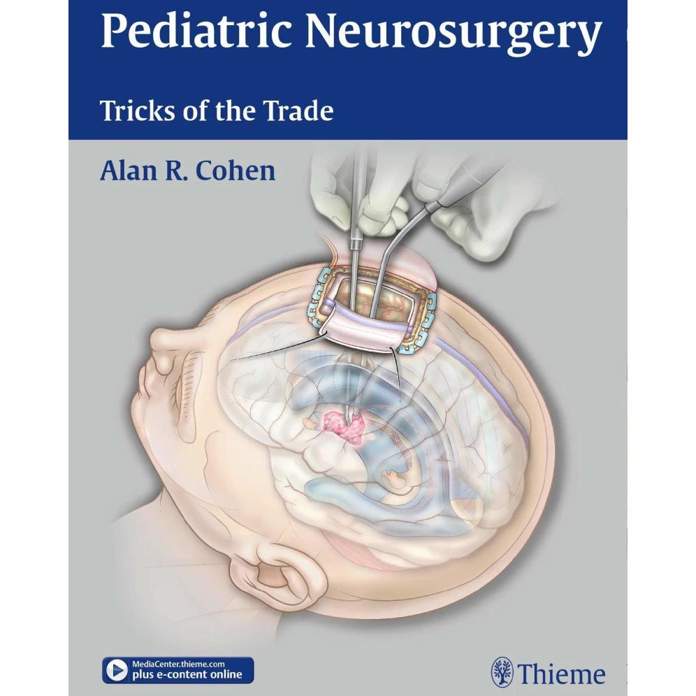 Pediatric Neurosurgery: Tricks of the Trade, Fachbücher von Alan R. Cohen