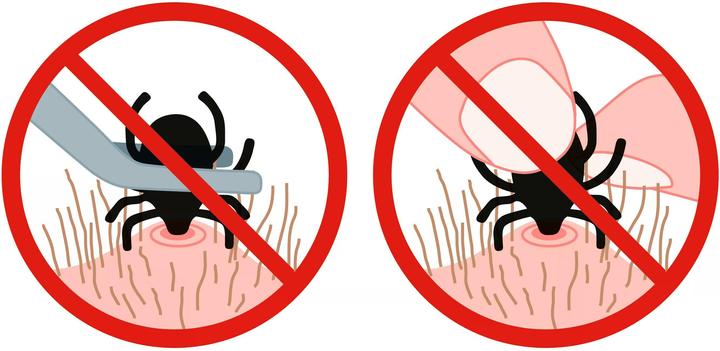 Immagine prodotto TickSafe Zeckengreifer