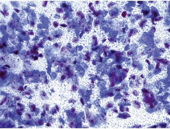 Actual product image Leica Microsystems Transmitted light microscope monocular 1000 x Mic