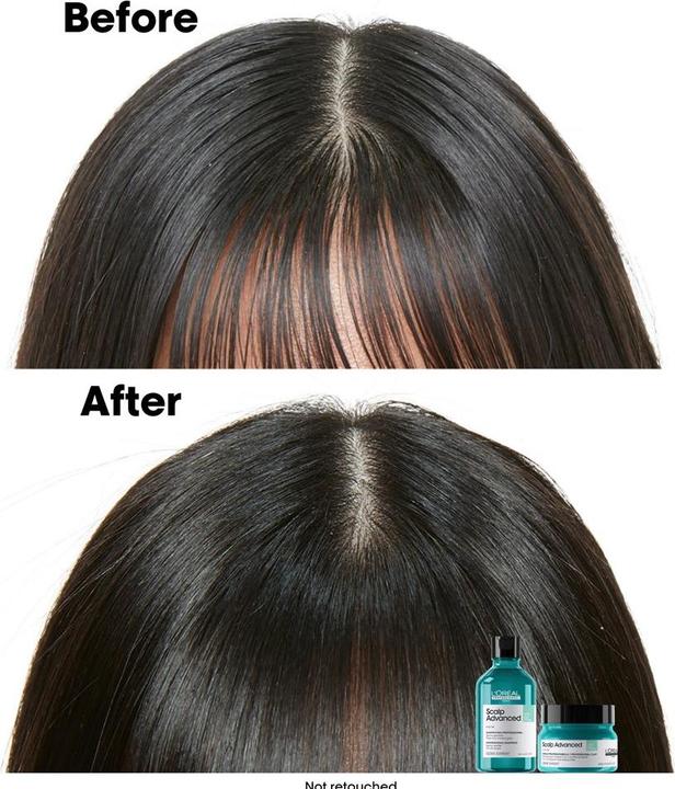 Produktbild L'Oréal Professionnel Série Expert Scalp Advanced - Anti-Oiliness Dermo-Purifier (Flüssiges Shampoo)