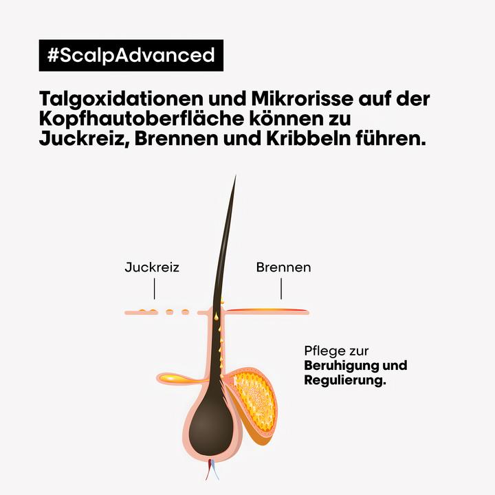 Immagine prodotto L'Oréal Professionnel Scalp Advanced (200 ml)
