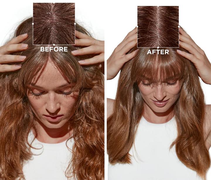 Image du produit Kérastase Symbiose Bain Pureté Anti-Pelliculaire (250 ml, Shampoing liquide)