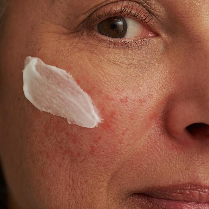 Immagine prodotto Dado Sens Maschera per il viso SENSACEA - Couperose, Rosacea e pelle leggermente arrossata (50 ml)