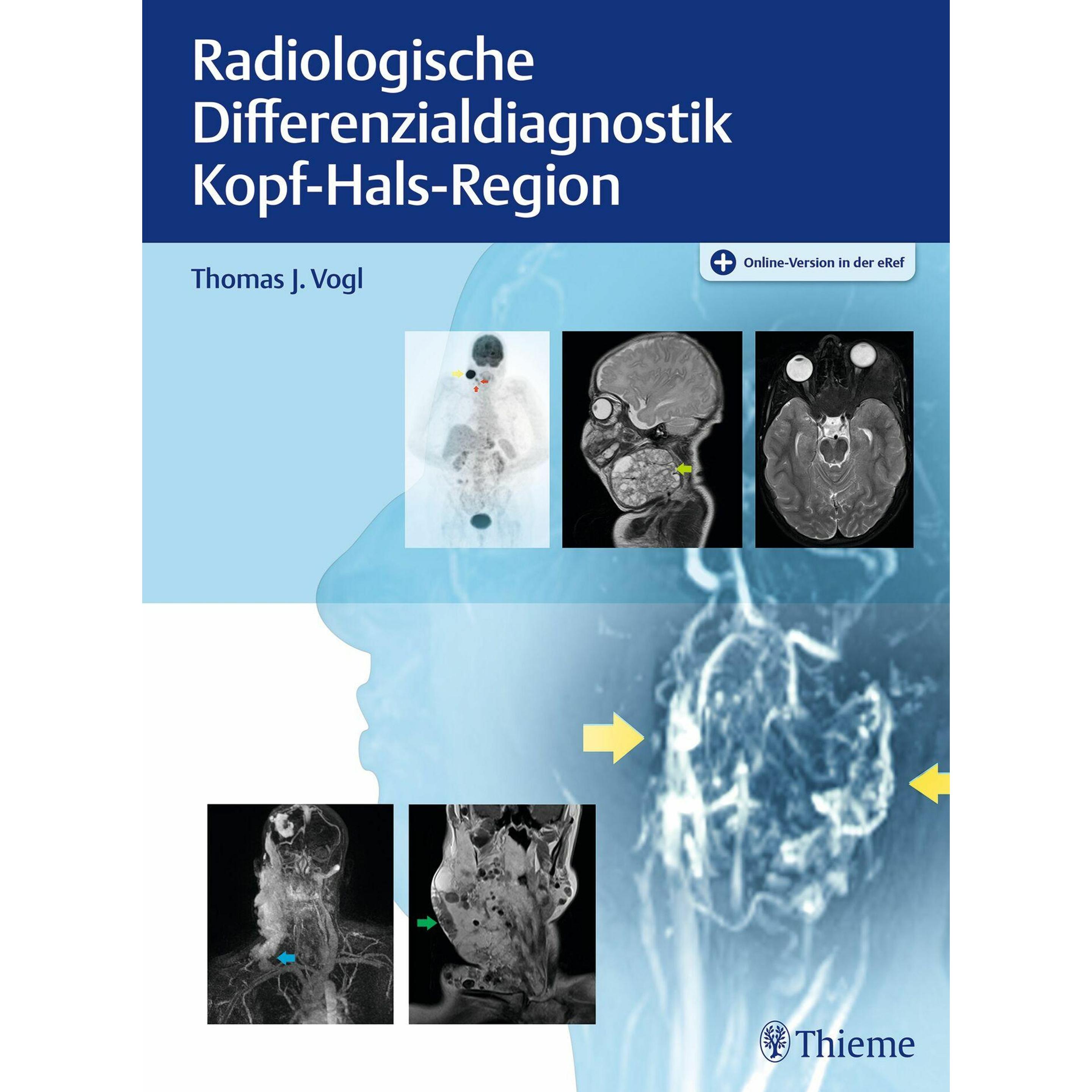Radiologische Differenzialdiagnostik Kopf-Hals-Region, Fachbücher von Thomas J. Vogl