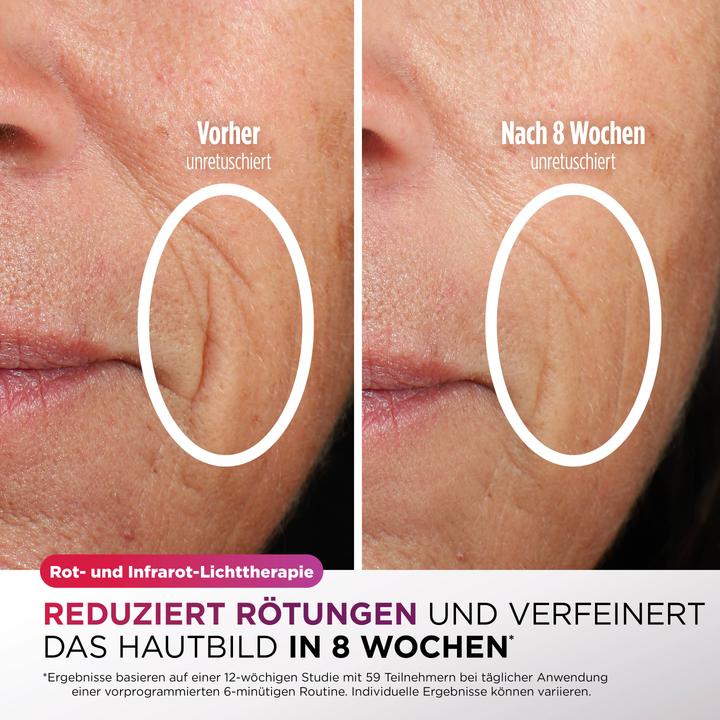 Produktbild Shark CryoGlow LED-Maske + FW312EUPL