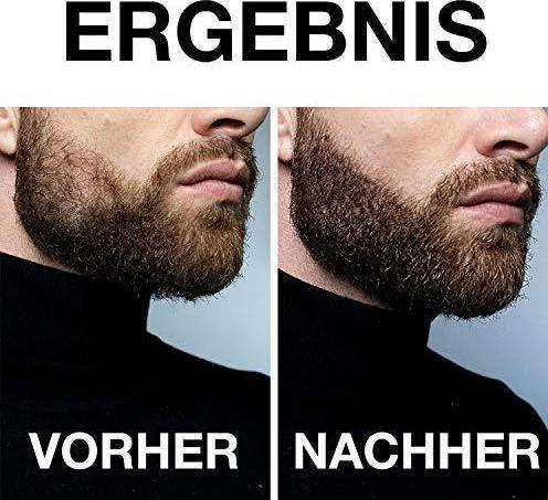 Produktbild Vinsk Dermaroller