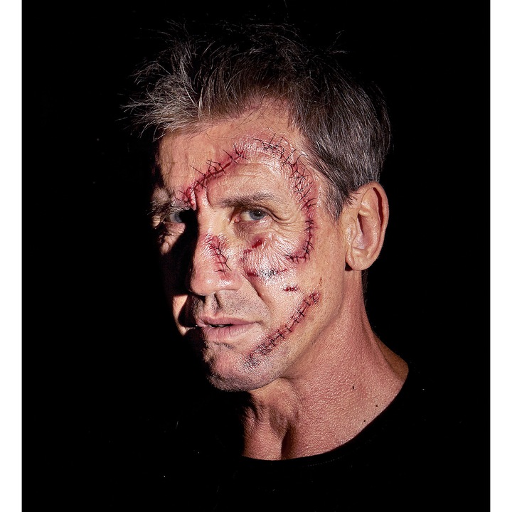 Actual product image Widmann Stitched wound