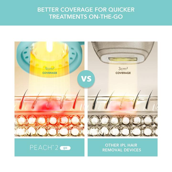 Image du produit Foreo Système d'épilation à lumière pulsée PEACH 2 Go - Bleu arctique, 1 pièce