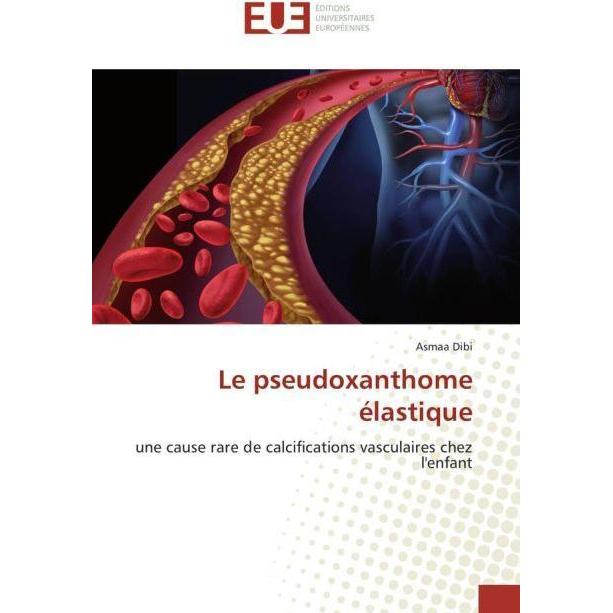 Le pseudoxanthome élastique, Fachbücher von Asmaa Dibi