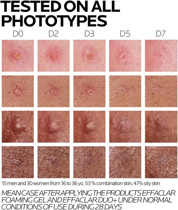 Produktbild La Roche Posay Effaclar Duo+M (40 ml, 24h Creme)