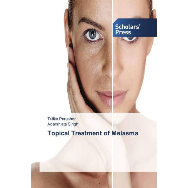 Topical Treatment of Melasma, Fachbücher von Adarshlata Singh, Tulika Parasher