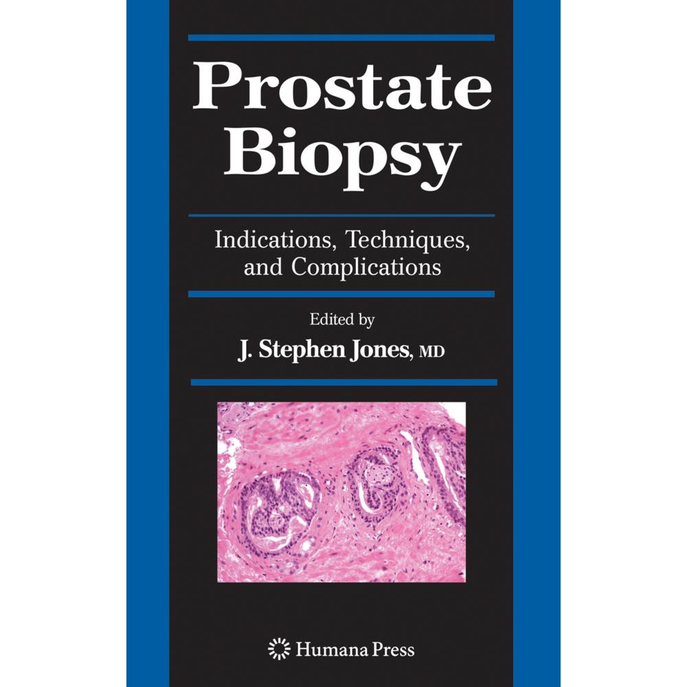 Prostate Biopsy, Fachbücher von J. Stephen Jones