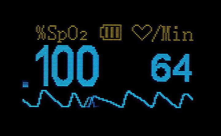 Produktbild Newgen medicals Finger-Pulsoximeter