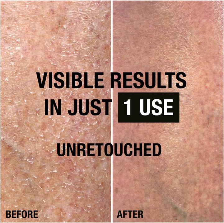 Actual product image Neutrogena Norwegian Formula Regenerating body emulsion for very dry, rough skin 400 ml (Body lotion, 400 ml)