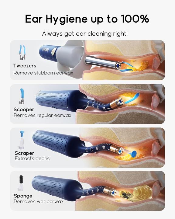 Produktbild Bebird EarSight Plus