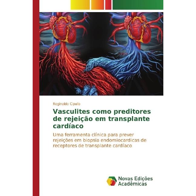 Vasculites como preditores de rejeição em transplante cardíaco, Fachbücher von Reginaldo Cipullo
