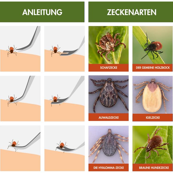 Produktbild Suba Zeckenzange 3er Set