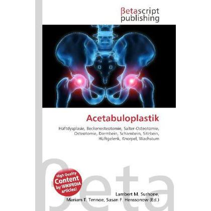 Acetabuloplastik, Fachbücher von Lambert M. Surhone, Miriam T. Timpledon, Susan F. Marseken