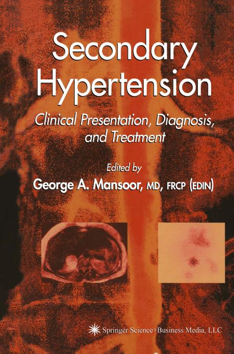 Secondary Hypertension (2010)