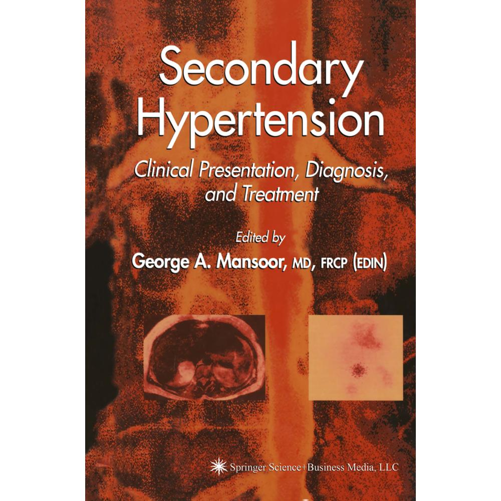 Secondary Hypertension, Fachbücher von George A. Mansoor