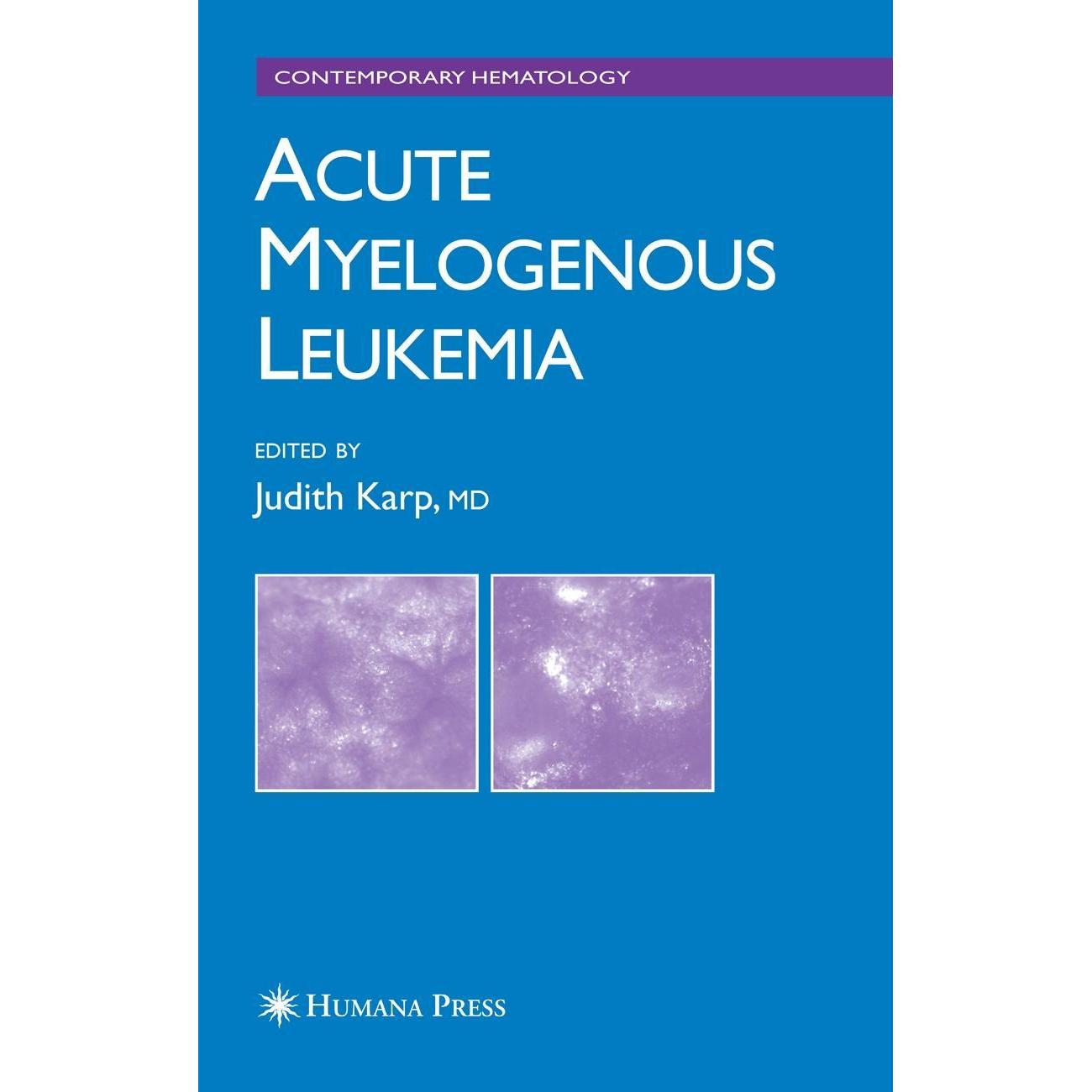 Acute Myelogenous Leukemia, Fachbücher von Judith E., Karp