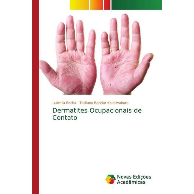 Dermatites Ocupacionais de Contato, Fachbücher von Yutaka Bacelar Kashiwabara, Tatiliana Bacelar Kashiwabara, Ludmila Ro...