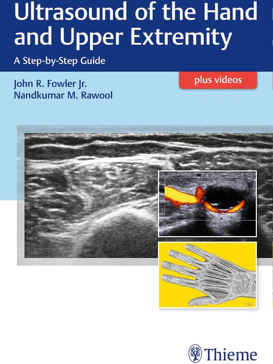 Produktbild Ultrasound of the Hand and Upper Extremity (Englisch, Nandkumar M. Rawool, John R. Fowler, 2017)