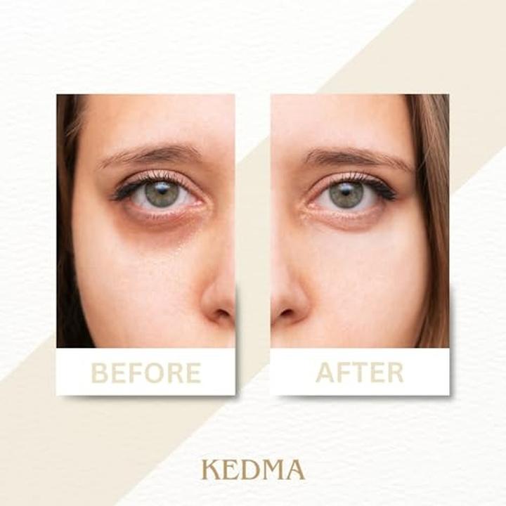 Actual product image Generic Eye Lifting Set with Serum and Cream