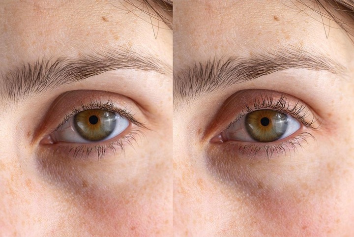 Produktbild TOP Beheizte Wimpernzange
