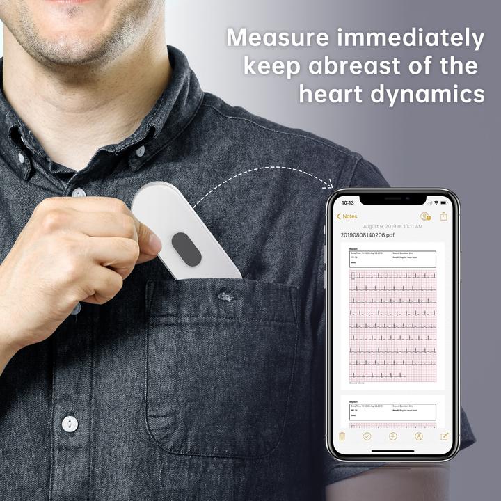 Image du produit ViatomTech DuoEK S - ECG Monitor