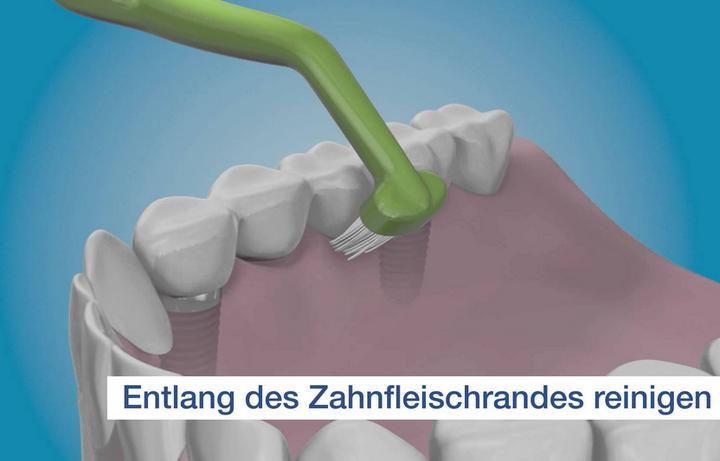 Actual product image TePe Universal Care Brush (1 x)