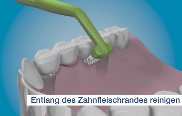 Actual product image TePe Universal Care Brush (1 x)