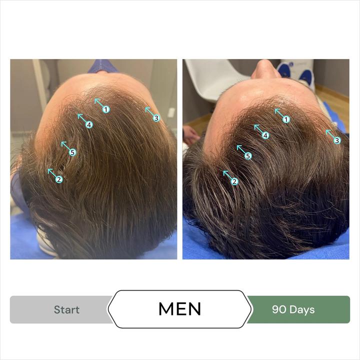 Produktbild DS Laboratories Revita Cbd Hair Stimulating Shampoo - 205ml (205 ml, Flüssiges Shampoo)