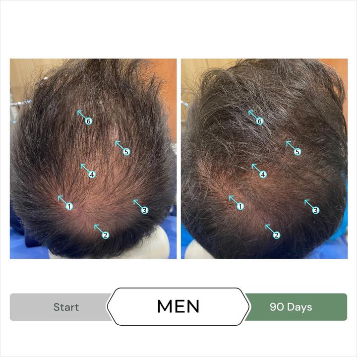 Produktbild DS Laboratories Revita Cbd Hair Stimulating Shampoo - 205ml (205 ml, Flüssiges Shampoo)