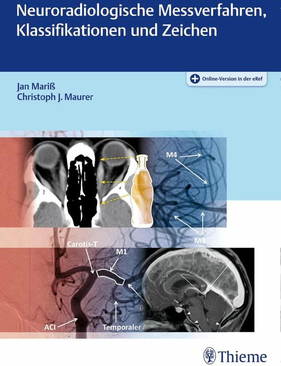 Produktbild Neuroradiologische Messverfahren, Klassifikationen und Zeichen (Deutsch, Christoph J. Maurer, Jan Mariss, 2018)