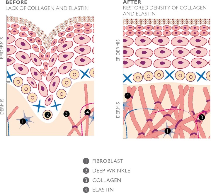 Actual product image Silk'n FaceTite Mini