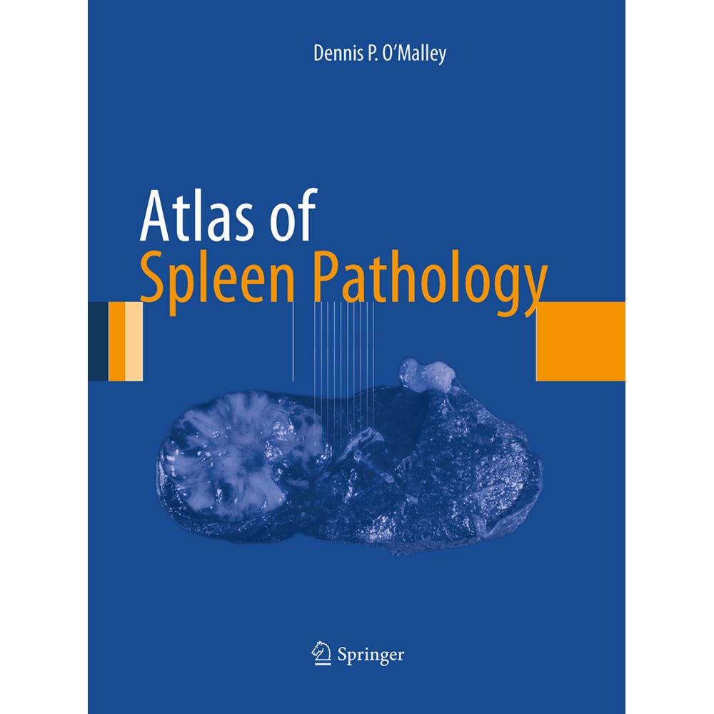 Atlas of Spleen Pathology, Fachbücher von Dennis P. O'Malley