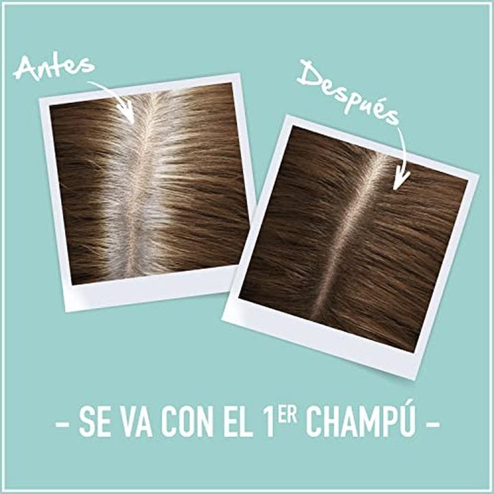 Immagine prodotto L'Oréal Paris Magic Retouch 1 Nero 100ml (Nero)