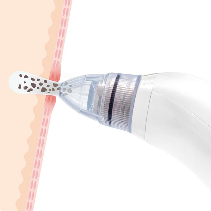 Actual product image InnovaGoods Pore Off